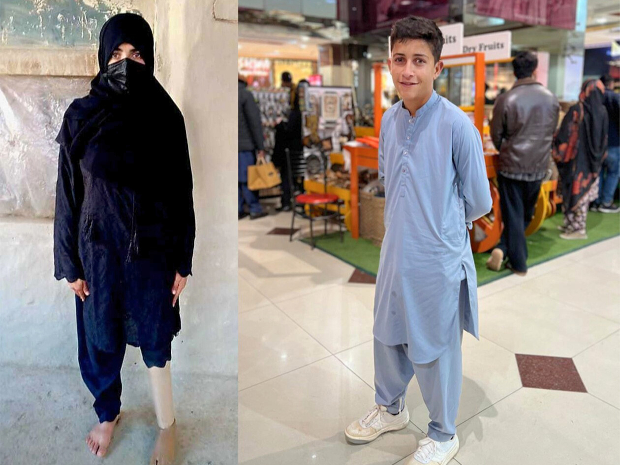 ズライハさんは左足に義足を装着