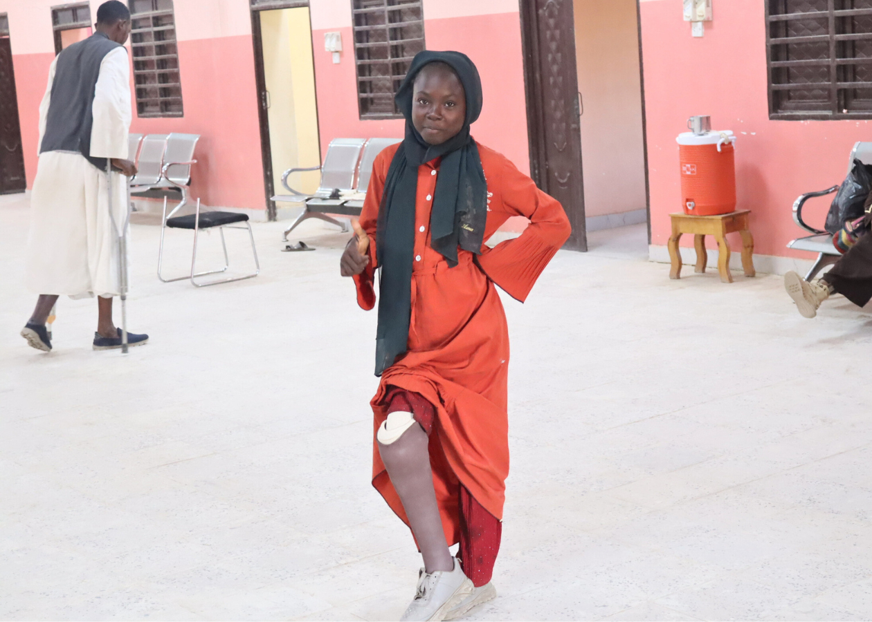 義足をこちらに見せるファティマさん